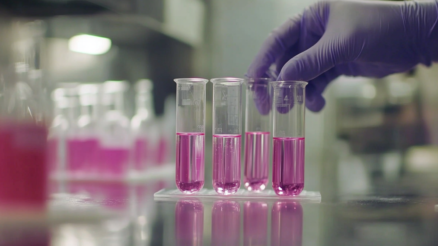 electrophoresis gel analysis